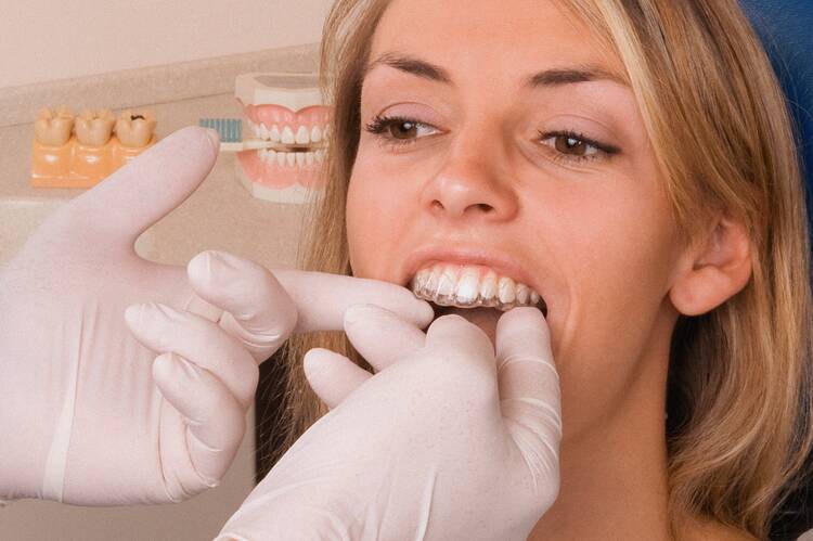 Invisalign - Korrektur von Zahnfehlstellungen